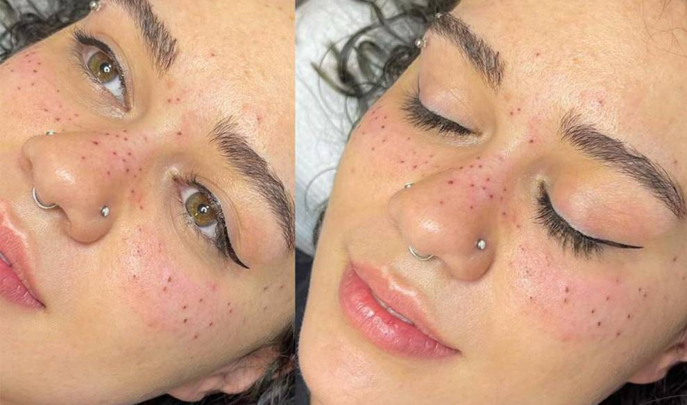 Pecas tatuadas en la cara, la tendencia sigue ganando seguidoras